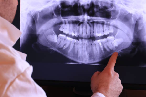 Best Dentist for Tooth Abscess  in St George, KS