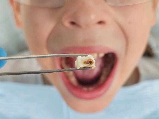  St George, KS Emergency Dentist Pros