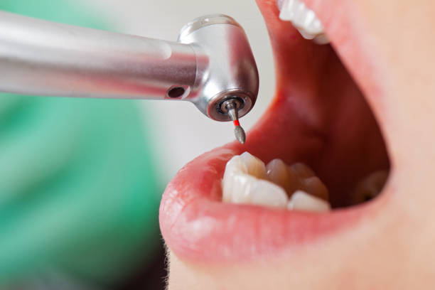 Best Dentist for Tooth Abscess  in St George, KS